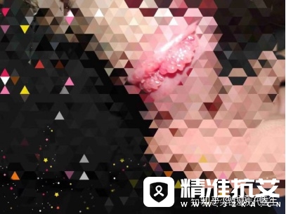 尖锐湿疣
